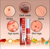 TAGS & MOLES REMOVER
