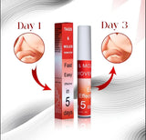 TAGS & MOLES REMOVER